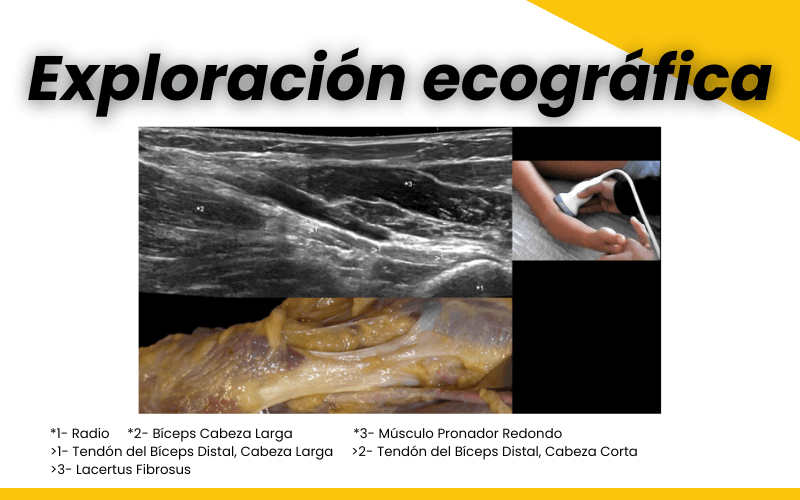 2. Ecografia tendon distal biceps tempo formacion.png